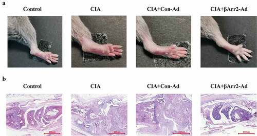 Figure 1. βArr2 improved the pathological process of RA in CIA mice. After constructing the CIA mice model, βArr2-Ad was injected into the ankle joint cavity once a week for 4 consecutive weeks. Mice of CIA and CIA+Con-Ad groups developed edema and erythema from the ankle to the entire leg compared to Control group, while mice of CIA+βArr2-Ad exhibited milder symptoms. (a) Redness and swelling of the ankle joints were observed. (b) H&E staining of ankle joint tissues
