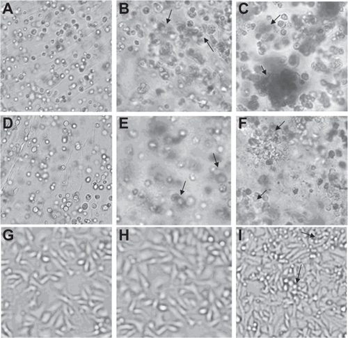 Figure 2 Phase contrast microscopy images of A–C) A2780, D–F) A2780/DDP, and G–I) SK-OV-3 cultured in RADA16-I peptide hydrogel on days 1, 3, and 7. The arrows indicate multicellular spheroids, cell clusters, or cell colonies. A, D, and G) indicate the initial cell morphology on the first day. B, E, and H) indicate the cell colonies of A2780, A2780/DDP, and SK-OV-3 after 3 days. C, F, and I) indicate the multicellular spheroids of A2780 and A2780/DDP and the cell clusters of SK-OV-3 after 7 days. All images are captured at ×200 magnification.