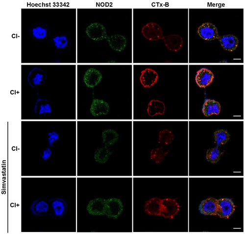 Figure 4. Inhibition of cholesterol synthesis reduces C. innocuum-induced NOD2 expression in lipid rafts. HT-29 cells were pretreated with simvastatin (100 μM) for 1 h prior to C. innocuum infection. Cells were probed with Hoechst 33,342 (blue), anti-NOD2 (green), and CTx-B (red), followed by confocal microscopy analysis. Bars, 5 μm.