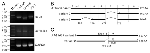 Figure 3. Analysis of transcripts of ATG5 and ATG16L1 genes in LNCaP and DU145 cells. Primers were designed to amplify ATG5 and ATG16L1 full-length encoding sequences by reverse transcription-polymerase chain reaction (RT-PCR). RT-PCR products were resolved by agarose gel electrophoresis (A). The RT-PCR products of ATG5 (B) and ATG16L1 (C) genes were cloned into the eukaryotic expression plasmid pEGFP-N1. Recombinant plasmids with expected inserts identified by restriction enzymes were analyzed by DNA sequencing. The results showed that LNCaP cells expressed a full-length ATG5 transcript (variant 1), while DU145 cells expressed two alternative spliced ATG5 variants (variant 2 lacking exon 6 and variant 3 lacking exon 2 plus exon 6) (B). However, LNCaP and DU145 cells were identified to express the same ATG16L1 transcript (variant 2 with an A898G mutation) (C). * indicates stop codon position.