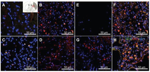 Figure 5 Doublecortin and bromodeoxyuridine staining was performed to detect the migrating exogenous subventricular zone neural progenitor cells in the hydrophilic or hydrophobic carbon nanotubes transplantation groups (A and D) 3 weeks or (E and H) 5 weeks after middle cerebral artery occlusion injury. The images show (A and E) the experimental control group (without subventricular zone neural progenitor cell transplantation), (B and F) injury-subjected rats transplanted with subventricular zone neural progenitor cells, (C and G) injury-subjected rats transplanted with hydrophilic carbon nanotubes impregnated with subventricular zone neural progenitor cells, and (D and H) injury-subjected rats transplanted with hydrophobic carbon nanotubes impregnated with subventricular zone neural progenitor cells.Notes: Doublecortin and bromodeoxyuridine double positive immunostained cells are indicated by yellow. Scale bars =50 μm.Abbreviations: BrdU, bromodeoxyuridine; DAPI, 4′,6-diamidino-2-phenylindole; DCX, doublecortin.