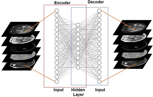 Figure 4. Illustration of an autoencoder used to learn a low dimensional representation of the high dimensional multiparametric MRI brain dataset by attempting to reconstruct it.