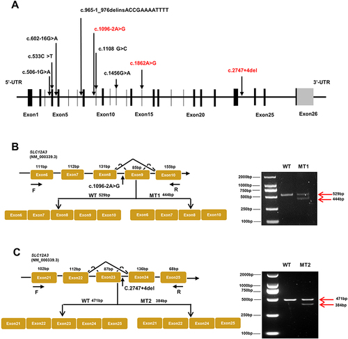 Figure 2 Schematic overview of SLC12A3 gene and representation of intronic variants on pre-RNA splicing in patients with GS. (A) The structure of SLC12A3 and its 26 exons which are indicated by black vertical lines. The black arrows in the diagram indicate the position of nine variations. Mutations that have been reported are shown in black, and those novel mutations in the manuscript are indicated by red. (B) Schematic overview of the region harboring c.1096–2A>G mutation in SLC12A3 and representation of the abnormal splicing. Representation of the alternative splicing of exon 9 in SLC12A3. Electrophoresis for amplification of SLC12A3 cDNA from the WT and No.1 patient (MT1). (C) Schematic overview of the region harboring c.2747+4del mutation in SLC12A3 and representation of the abnormal splicing. Representation of the alternative splicing of exon 23 in SLC12A3. Electrophoresis for amplification of SLC12A3 cDNA from the WT and No.2 patient (MT2). Red arrows indicate the position of MT and WT in agarose gel. WT represents wild-type and MT represents mutant type.