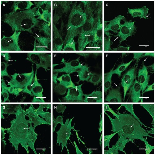 Figure 8 Immunofluorescence of talin (A–C), vinculin (D–F), and beta-actin (G–I) in human osteoblast-like MG-63 cells on day 3 after seeding on pure PLGA scaffolds (A, D, and G), composite PLGA-ND scaffolds (B, E, and H), and polystyrene culture well (C, F, and I).Notes: Leica confocal laser scanning microscope (TCS SP2, Germany), objective 20×, zoom 8× (A) 8.5× (B), or 6× (remainder of pictures); bar 25 μm.Abbreviations: PLGA, copolymer of L-lactide and glycolide; ND, nanodiamond.