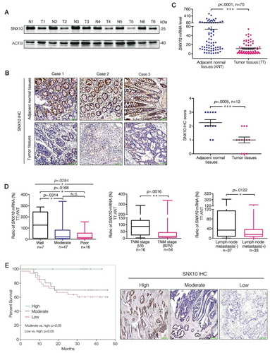 Figure 1. SNX10 is down regulated in tumor tissues of CRC patients and closely related to clinicopathological factors. (A and B) Representative immunoblots and IHC images of SNX10 in tumor tissues (T) and paired adjacent normal tissues (ANT; N) of CRC patients. Scale bar in (B): 100 μm. (C) SNX10 mRNA levels in TT and paired ANT from 70 CRC patients were measured using RT-qPCR. (D) The ratio of SNX10 mRNA level in TT to paired ANT was calculated, and its clinical correlations with clinicopathological factors were analyzed. (E) The Kaplan-Meier survival curve of 70 CRC patients grouped based on the levels of SNX10 expression in tumor tissues. Survival analysis was performed using log-rank test. Right panel: Representative IHC images of SNX10 in tumor tissues. Scale bar: 100 μm. Data are represented as mean ± SEM (B, C) or median with upper/lower quartile and maximum/minimum values (D). NS, not significant; *, p < 0.05; **, p < 0.01; ***, p < 0.001; by 2-tailed, unpaired t-test.