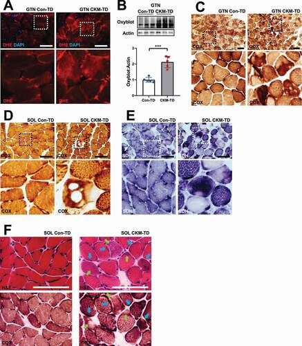 Figure 8. Oxidative injuries and mitochondrial abnormalities in CKM-TD muscle tissue. (A) GTN muscle from Con-TD and CKM-TD was stained with dihydroethidium (DHE) staining that visualizes superoxide radicals. Boxed areas are magnified below. (B) Oxyblot analysis of indicated muscle lysates. The presented oxyblot data covers the entire area between 37kD and 75kD molecular weight markers. Oxyblot intensities were quantified (n = 5) in the bottom panel. Data are presented as mean±SD with individual values. ***P < 0.001 in Student’s t-test. (C-E) GTN (C) and SOL (D and E) tissues were stained for mitochondrial COX (C and D) and SDH (E) enzymatic activities. Boxed areas are magnified below. (F) Serial sections of SOL were stained with H&E (upper) and COX assay (lower). Degenerating fibers exhibit aberrantly higher (blue arrows) or lower (green arrows) activities of COX. Scale bars: 100 µm.