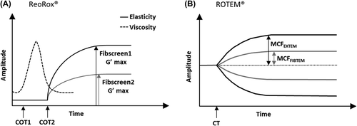 Figure 1. ReoRox® and ROTEM® output traces. The ReoRox® device displays information on viscosity (dashed curve) and elasticity (plain curve) during the coagulation process (A). Viscosity parameters include the time of the initial formation of fibrin strands (COT1) and the time to complete clot formation (COT2) before the clot starts to strengthen. Clot strength is represented by the maximum elasticity parameter G'max obtained either in the absence (Fibscreen1 G'max) or presence (Fibscreen2 G'max) of platelet inhibitor. Similar coagulation parameters are obtained with the ROTEM® system (B), the equivalent of COT2 being the clotting time (CT, time from start to 2 mm amplitude). Maximum clot firmness (MCF) parameters, obtained either in the absence (EXTEM test) or presence (FIBTEM test) of platelet inhibitor, can be converted into maximum clot elasticity (MCE) parameters, using the following formula: MCE = (MCF × 100)/(100 − MCF).
