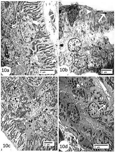 Figure 10. Electron micrographs of kidney sections of distal convoluted tubules (a): control group showing lining cells with spherical to oval nuclei (N), extending deeply basal cell infoldings with numerous elongated mitochondria in between (M), and somewhat thin basal lamina (arrow) (Scale bar = 2 µm). (b): CCl4 group showing region of cytoplasm rarefaction (astric), marked degenerated lining cells (arrow), swollen degenerated basal infolded mitochondria (M) and obvious loss of basal infoldings (arrow head) (Scale bar = 2 µm). (c) CCl4 + rats’ BM-MSCs and (d): CCl4 + mice BM-MSCs showing marked recovery of the nucleus (N), elongated mitochondria (M), and well-defined basal infoldings (arrow) (Scale bar = 2 µm).