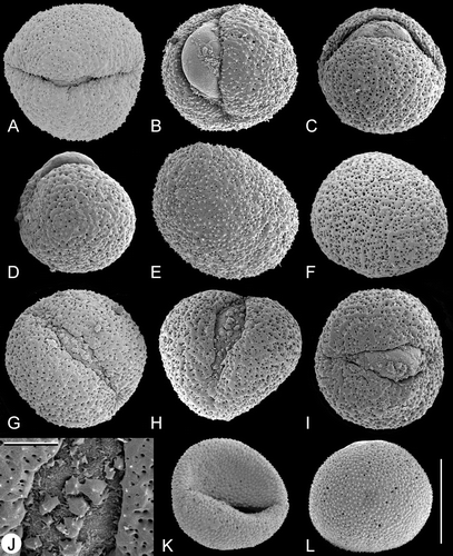 Figure 2. A–L. SEM, pollen grains of Trithuria spp. with bisexual reproductive units from southern Australia. A–J. T. submersa: (A–C) and (E–J) Macfarlane 3902; (D) Conran 961 & Rudall. (A–I) Different views of pollen grains; note that small patches of ectexine are visible on the aperture membrane in (G–I); (J) detail of an aperture with small patches of exine. K–L. T. bibracteata, different views of pollen grains. Scale bars – 10 µm (A–I, K–L); 2 µm (J).