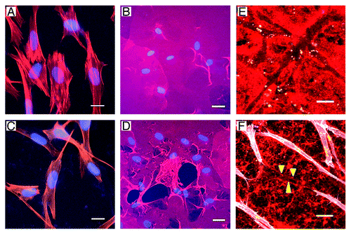 Figure 2. Normal human fibroblasts transfected with an empty vector (EV) remained boxy in appearance and had no effect on collagen or matrigel when exposed to wounding media (A and B). In contrast, fibroblasts transfected with wild-type palladin (WT) became elongated with mesenchymal features (C), caused destruction of the collagen matrix (D) with apparent clumping of the collagen edges. Additionally, palladin-expressing fibroblasts created tunnels in matrigel (stained red) when exposed to wounding media in 3D invasion cultures (E). Fibroblasts, stained white in (F), became quite elongated when tunneling. Tunnel is delineated by yellow arrowheads. Scale bars indicate 20 μm.