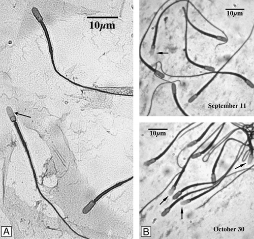 Figure 4 Acrosome reaction of C. mexicanus epididymal sperm. The acrosome reaction was assessed during a 60 min incubation, of previously capacitated spermatozoa, in the presence of 3.18 μM progesterone (final concentration). Afterwards aliquots were removed, fixed, and the percentage of acrosomally reacted spermatozoa determined by the coomasie brilliant blue method. Presence and number of stained and unstained spermatozoa was determined at high magnification. (A) Lack of blue staining of the acrosome region (arrow) indicates reacted acrosomes. Blue staining of the acrosome region forming a distinct apical ridge, indicates intact acrosomes of unreacted spermatozoa. (B) Comparison between the epididymal cauda spermatozoa observed in September 11 and October 30, showing the increase in the percentage of acrosome reacted sperm.