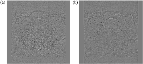 Figure 8 Residual images of an example MR slice that was filtered by baNLM (a) and the same image filtered by NLM (b). Visual inspection reveals less discernable anatomical features in baNLM than NLM.