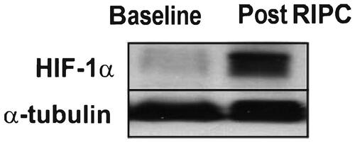 Figure 5. An image showing the stabilization of HIF1α after RIPC using the Western Blot method.