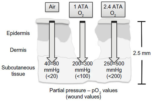Figure 1 Partial pressure of oxygen in normal and wounded subcutaneous tissue upon exposure to air, oxygen, and hyperbaric oxygen.