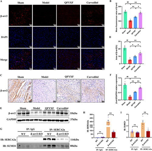 Figure 5 QFYXF promotes β-arrestin2-mediated the SUMOylation of SERCA2a in failing myocardium. (A) Immunofluorescence images of β-arr2; (B) Mean fluorescence value of β-arr2 (n=5); (C) Immunohistochemical images of β-arr2; (D) Area of β-arr2 (n=5); (E) Images of β-arr2 proteins expression; (F) β-arr2/GAPDH relative expression (n=6); (G) CO-IP of SERCA2a and SUMO1; (H) IB: SERCA2a (n=6); (I) IB: SUMO1 (n=6). Data are presented as Mean ± SEM. Vs sham group, ##P < 0.01; vs model or WT group, *P < 0.05, **P < 0.01.