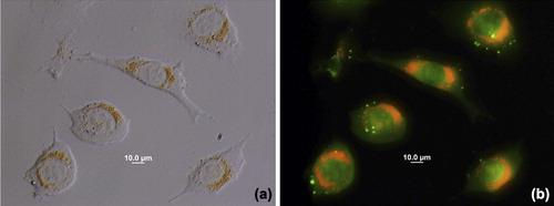 Figure 4. Fluoresence microscopy images of L929 cells. a) Transmission and b) fluoresence after 24 h incubation at 37°C with AO-loaded PHEMA nanoparticles. Different labeling of cell membranes or compartments can be noticed indicating the release of the AO has occured from polymeric nanoparticles.