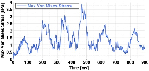 Figure 2. Von Mises stresses of the spinal cord over time (blue).