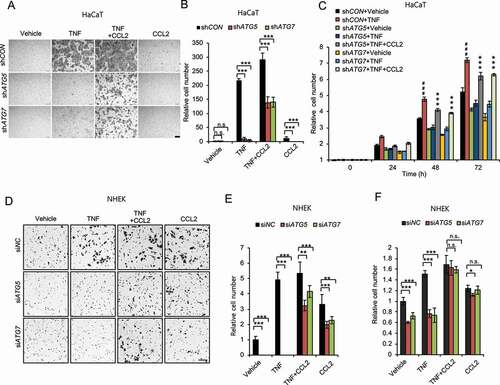 Figure 5. Autophagy promotes keratinocyte migration and proliferation through CCL2. (A) Representative images of cell migration assay with HaCaT cells with or without knockdown of either ATG5 or ATG7 treated with or without TNF (100 ng/ml) and/or CCL2 (100 ng/ml) for 24 h. Scale bars: 200 µm. (B) Quantification of A (n = 8). (C) Cell proliferation assay in cells as in A (n = 3). ***, P < 0.001; compared with its corresponding group without CCL2 treatment. ###, P < 0.001; compared with the shCON+Vehicle group. (D) Representative images of cell migration assay with NHEK cells, transfected with siNC, siATG5 and siATG7, treated with or without TNF (100 ng/ml) and/or CCL2 (100 ng/ml) for 1 d. Scale bars: 100 µm. (E) Quantification of D (n = 8). (F) Cell proliferation assay in NHEK cells transfected with siNC, siATG5 and siATG7, then treated with or without TNF (100 ng/ml) and/or CCL2 (100 ng/ml) for 2 d (n = 3). All bars represent mean ± SD; *, P < 0.05; **, P < 0.01; ***, P < 0.001; Student’s t-test. Results were obtained from at least three independent experiments (A-F)