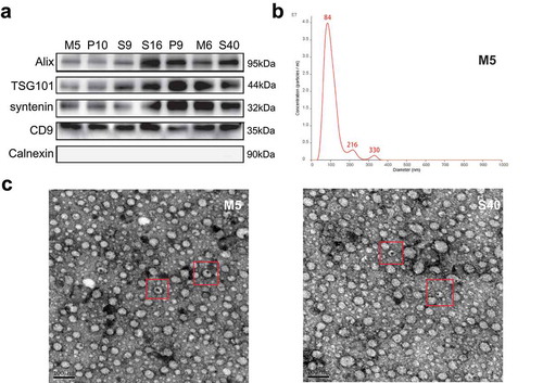 Figure 2. Characteristic proteins and morphology of extracellular vesicles (EVs). (a) The protein levels of Alix, TSG101, syntenin, CD9, and Calnexin in the EVs of seven representative samples were assessed using western blotting. (b) Nanoparticle tracking analysis results from representative EVs samples are shown. (c) Images of EVs from two representative samples were taken by scanning electron microscopic analysis. The representative EVs morphology is highlighted by a red box.