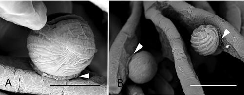 Figure 17. Scanning electron microscopy of Hyalophysa lynni attached to Litopenaeus setiferus gills. A. A cyst containing multiple tomites. The wall has collapsed upon the daughter cells. The secreted attachment peduncle is indicated (arrowhead). B. Two cysts. The cyst on the right has a collapsed wall, revealing the spiraling ciliary rows of the encysted trophont stage. Attachment peduncles, arrowheads. Scale bars 25 µm (A), 50 µm (B). Figures are new.