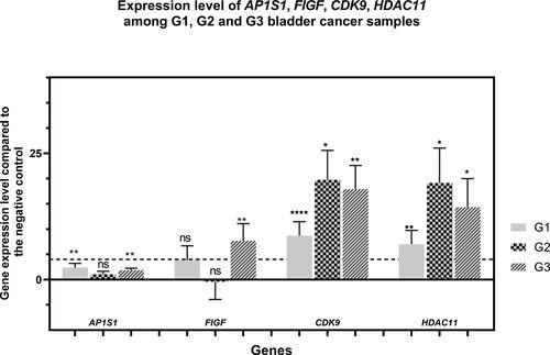 Figure 4. Expression levels of AP1S1, FIGF, CDK9 and HDAC11 genes among the tested clinical groups in terms of tumor grade. The average expression levels of the tested genes are shown in relation to the tumor grade. Dashed line marks cutoff 4-fold change in gene expression. Error bars show standard deviation of the means. The separate clinical groups are uroepithelial tumors with histological grade G1, G2 and G3 . P value < 0.0001 found by One-way ANOVA. . ”*” indicates a P-value less than 0.05, “**” indicates a P-value less than 0.01 “***”indicates a P-value less than 0.001, “***” indicates a P-value less than 0.0001 for one-sample Wilcoxon test, “ns” indicates nonsignificant.