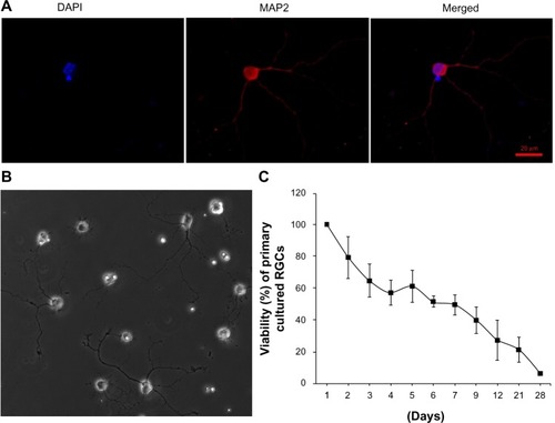 Figure 4 The identification, morphology, and survival curve of primary cultured RGCs.