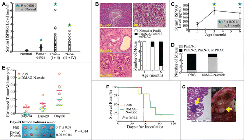 Figure 1. Elevation of secreted HSP90α levels during PDAC development. (A) Differences in average levels of serum HSP90α between normal volunteers (n = 10) and pancreatitis patients (n = 20), between normal volunteers and stage-I & II patients (n = 80), and between normal volunteers and stage-III & IV patients (n = 34) were all statistically significant (P < 0.05, designated by an asterisk). (B) Different stages of lesions identified in the pancreatic tissues of LSL-KrasG12D/Pdx1-Cre mice at 1, 3, and 6 months of age (n = 6 in each age group) by Hematoxylin and Eosin (H&E) staining. Representative histopathological lesions of PanIN-1, PanIN-2, PanIN-3, and PDAC are shown and identified according to the characteristics described previously,Citation41 200 ×. The tumor stage in each mouse was designated based on its most advanced lesions. (C) Serum HSP90α levels of LSL-KrasG12D/Pdx1-Cre mice at 1, 3, and 6 months of age (n = 6 in each age group; mean ± SD). (D) Inhibition of the PDAC development in LSL-KrasG12D/Pdx1-Cre mice by DMAG-N-oxide treatment described in Materials and Methods. The mice were sacrificed at 7 months of age and examined for histopathological lesions in pancreatic tissues. (E) Inhibition of the tumor formation of Panc-02 cell grafts in C57 BL/6 mice by DMAG-N-oxide treatment described in Materials and Methods. The tumor sizes were measured superficially since Day-14 post-transplantation. The mice were sacrificed on Day-29 and the tumor volumes were calculated as ½ × length × width2 (cm3). (F) Inhibition of the metastasis of Panc-02 cell grafts in C57 BL/6 mice by DMAG-N-oxide treatment described in Materials and Methods. Survival rates of the mice were calculated and analyzed by Kaplan-Meier method and log-rank test. (G) Representative images of a tumor nodule in the H&E-stained lung tissue section (left panel) and a tumor mass behind the lung (right panel, photographed after pneumonectomy) obtained from PBS-treated Panc-02-inoculated mice.