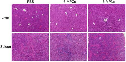 Figure 9 Livers and spleens of mice from different groups were embedded with paraffin and stained with hematoxylin and eosin (H&E). Scale bar, 50 μm.