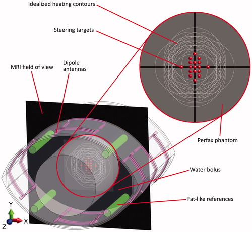 Figure 1. Cross-section of the phantom (grey central circle) in the applicator. The dipole antennas are purple; the green cylinders are the reference tubes filled with fat-like material that is used for B0 drift correction. The black plane is the MRI field of view. Red dots are the steering targets and the white circles represent the corresponding idealised 50% heating contours. These steering settings are representative since, in clinical practice, heating targets are generally centrally located.