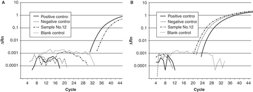 Figure 1. An original amplification plot of real-time PCR in case no. 12 with positive CMV DNA. CMV DNA in positive control and case 12 (A) and genomic DNA (GJB2 gene) in positive control, case no. 12 and negative control (B) are amplified. These results show that our real-time PCR method is precise. Blank, sample without any added DNA.