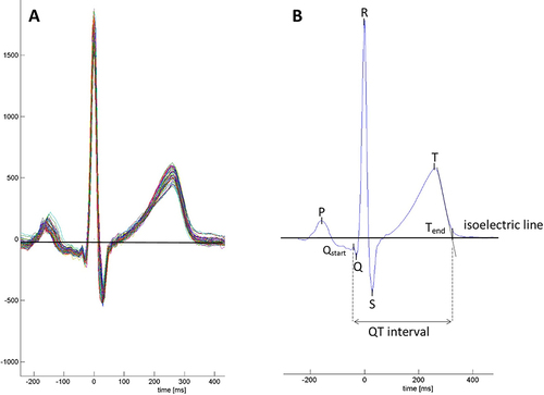 Figure 1 Single and averaged ECG waveforms as illustrated by Bisang et alCitation22 (A) Beat-by-beat ECG superimposed over a 1-minute period. (B) 1-minute average ECG waveform with algorithm-based ECG marker placement. P, P-wave, Qstart, the beginning of the Q-wave and start of the QT interval; T, T-wave peak; Tend, end of T-wave and end of the QT interval, set at the connection point between the tangent of the steepest downslope of the T-wave and the isoelectric line.