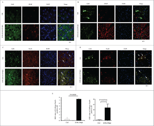 FIGURE 2. Immunofluorescent analysis of the associations of CaM with different kinds of CNS cells of normal and scrapie-infected hamsters collected at early and terminal stage. Representative images double-immunostained with the antibodies for CaM (green) and GFAP (red) on the slices from the hamsters of 20 dpi (A) and 80 dpi (B), or that for NeuN (red) from the hamsters of 20 dpi (C) and 80 dpi (D) (× 40). The normal controls are the individual age-matched healthy hamsters. The merged signals are shown with the white arrow. E. Analyses of the IOD values with the software in Operatta. The average IOD values of CaM per NeuN-positive cell (× 105). Left panel: the infected hamsters of 20 dpi. Right panel: the infected hamsters of 80 dpi. Statistical differences between the infected animals and the individual normal controls are indicated above.