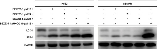 Figure 8 Effect of BEZ235 alone or in combination with CQ on LC3 protein.
