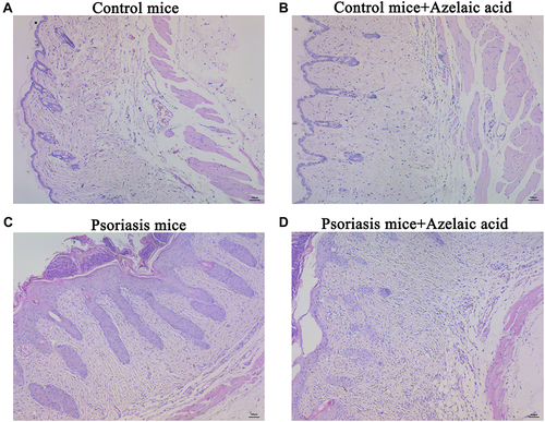 Figure 2 Microscopic observation of target skin tissue of mice in blank control (A), negative control (B), psoriasis model (C) and azelaic acid treat groups (D). Observe under 100x microscope.