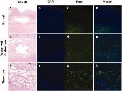 Figure 5. Pathological staining and TUNEL immunofluorescence staining results of beagle liver vessels. Results of pathological staining with hematoxylin and eosin (HE), staining with DAPI (blue), co-stained with TUNEL (green representing apoptosis) and merging (blue and green) (from the first column to the fourth column) (×50). The vascular wall cells are still well-formed in (A–D). The vascular wall is damaged in (E–H). The thrombus is observed in (I–L).