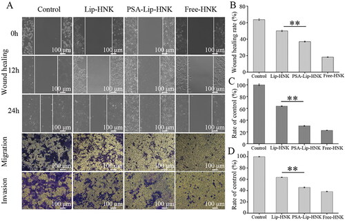 Figure 4. In vitro inhibitory effects of PSA-Lip-HNK on cell migration and invasion of 4T1 breast cancer cells. A: Typical images of wound healing, migration and invasion assessments of free HNK, Lip-HNK and PSA-Lip-HNK (5.0 µg/mL) on 4T1 cells. B–D: Quantified inhibitory effect of free HNK, Lip-HNK, and PSA-Lip-HNK (5.0 µg/mL) on 4T1 cells in comparison with negative control. Data are shown as mean ± SD (n = 3), **p < .01.