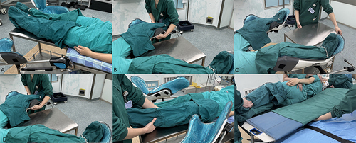 Figure 2 Postural trolley-assisted over-bed method. Placement—(A): Place the postural trolley; (B): Positioning the patients in the lithotomy position; (C): Remove the postural trolley. Repositioning—(D): Place the postural trolley and repositioning; (E): Flat one’s legs. Transition to the bed—(F): Transition to the bed.