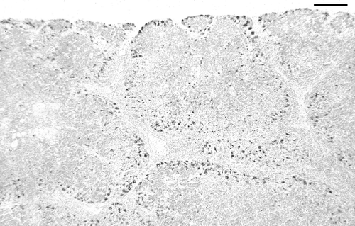Figure 2.  IPX-stained section of thymus showing abundant CAV antigen (dark) located mainly in the outer cortex of lobules. Day 13 p.i., bird inoculated when 3 weeks of age. Bar = 125 µm.