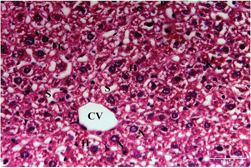Figure 10. A photomicrograph of a liver section of HCC animals treated with IQ (20 mg/kg bw) showing central vein (CV), blood sinusoids (S), hepatocytes (H) with moderately Figure vacuolated cytoplasm, and central rounded nuclei (N). Kupffer cells (K) are also seen (H&E x400).