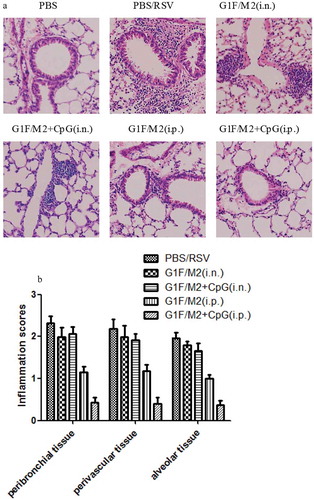 Figure 5. Pulmonary pathology following RSV challenge. Tissue sections were obtained from each mouse after 5 d of post-challenge. Lung histology was stained by H&E. (a) A image for a representative animal of each group. (b) Scores for pulmonary inflammation as described in Section 4. Results are means ± SD of five or six mice per group.