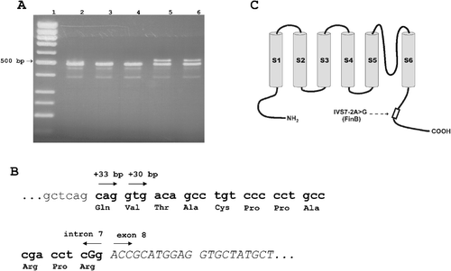 Figure 2. A) Reverse transcription polymerase chain reaction (RT‐PCR) of lymphocytic RNA to characterize the KCNQ1 IVS7‐2A>G mutation. Lane 1: molecular weight marker; Lanes 2–4: RT‐PCR products from control blood samples; Lanes 5–6: RT‐PCR products from individuals carrying the KCNQ1 IVS7‐2A>G mutation. The size of the fragment corresponding to the wild‐type allele is 482 bp, while the corresponding sizes of the mutant alleles (as determined by DNA sequencing) are 512 and 515 bp. B) DNA and amino acid sequences of the in‐frame insertions of 30 or 33 bp (marked in bold) corresponding to the mutant allele in KCNQ1 IVS7‐2A>G carriers. The IVS7‐2A>G mutation at the end of intron 7 is indicated with the capital letter G. C) A schematic view of the KCNQ1 protein with the KCNQ1 IVS7‐2A>G (KCNQ1‐FinB) mutation located in the C‐terminal part.