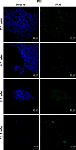 Figure S3 Fluorescence microscopy of HEK 293 cells treated with PEI/FAM-miR-503 at different polymer to miRNA ratios (w/w) that indicate the best ratio to use in transfections.Abbreviation: PEI, polyethyleneimine.