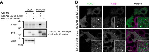 FIG 3 The p62 variant lacks the ability to bind Keap1. (A) Immunoprecipitation assay. FLAG-tagged full-length or variant p62 was expressed in p62−/− MEFs, and cell lysates were subjected to immunoprecipitation with anti-FLAG antibody. The immunoprecipitates were examined by immunoblotting with the indicated antibodies. Data are representative of three independent experiments. (B) Immunofluorescence analysis. 3×FLAG-tagged p62 or its variant was expressed in p62-knockout Huh1 cells by use of an adenovirus vector system, and the cells were immunostained with anti-FLAG and anti-Keap1 antibodies. Each inset is a magnified image. Bar, 20 μm.