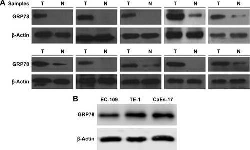 Figure 1 The expression of GRP78 protein in ESCC tissues and cell lines was assessed through Western blot.