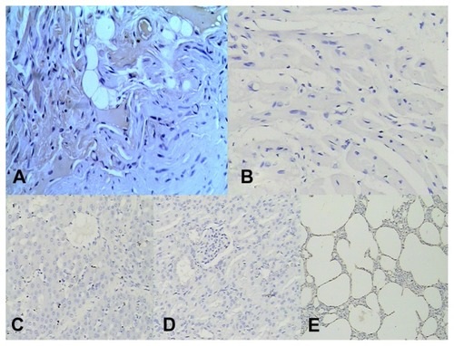 Figure 5 (A) t-PA-positive reaction was seen in myocardial, vascular, interstitial cells of the heart tissue exposed to ultrasonic field. There was no positive reaction observed in the same tissue without ultrasound in experimental group; (B) No t-PA positive cells were found in heart tissue in control group; (C) No t-PA positive cells were found in liver; (D) No t-PA positive cells were found in kidney; immunohistochemical stain 200×; (E) No t-PA positive cells were found in lung; immunohistochemical stain 100×.Abbreviation: t-PA, tissue-type plasminogen activator.