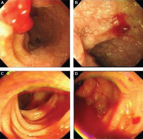 Figure 1 Endoscopic examinations.