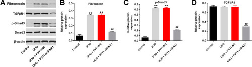 Figure 6 Knockdown of PVT1 suppressed renal fibrosis in vivo by inhibition of TGF-β pathway. (A) The protein expressions of Fibronectin, TGF-βR1, p-Smad3 and Smad3 in tissues of mice were measured by western blot. (B) The relative protein expression of Fibronectin was quantified by normalizing to β-actin. (C) The relative protein expression of p-Smad3 was quantified by normalizing to β-actin. (D) The relative protein expression of TGF-βR1 was quantified by normalizing to β-actin. **P < 0.01 compared to control, ##P < 0.01 compared to UUO.