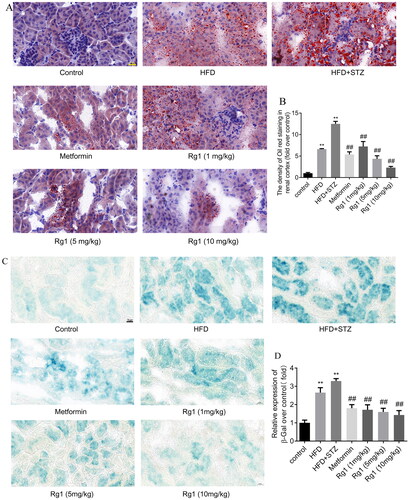 Figure 2. Effect of Rg1 treatment on renal lipid deposition and cellular senescence in T2DM mice. (A) The results of lipid deposition in the renal cortex (Oil Red O staining, ×400). (B) The mean density of Oil Red O staining in the renal cortex. (C) The results of cellular senescence in the renal cortex (β-Gal staining, ×400). (D) The mean density of β-Gal staining in the renal cortex. The data are expressed as the means ± SD, n = 4. **p< 0.01 compared with the control group; ##p< 0.01 compared with the HFD + STZ group.