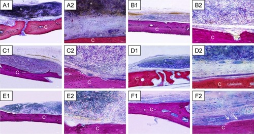 Figure 9 Histological evaluation after 6 weeks of healing.Notes: Magnification is 4× for A1–F1 and 40× for A2–F2. (A) Evo. Membrane appeared structurally intact, able to cover all the defect area, and well integrated with the host tissue. (B) Evo + hPDLSCs. This group showed good integration with vascularized extracellular matrix around the native bone. (C) Evo + EVs. Islets of new bone were integrated with native bone. Membrane appeared closely adapted to host-bone tissue and well integrated with native bone. (D) Evo + EVs + hPDLSCs. (E) Evo + PEI-EVs. Evo was well integrated with host tissue, and extracellular matrix was present in defect area. (F) Evo + PEI-EVs + hPDLSCs. The implant site was covered with an organized extracellular matrix with mineralization areas, and osteoblast-like structures were visible. C, mouse calvarium; *Evo; arrows, osteoblast-like cells. Scale bars =10 μm.Abbreviations: Evo, Evolution; hPDLSCs, human periodontal-ligament stem cells; EVs, extracellular vesicles; PEI, polyethylenimine.