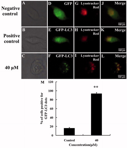 Figure 5. HBC increased formation of autophagosomes and fusion with lysosomes. A549 cells expressing GFP-LC3 were treated with HBC and the accumulation of LC3 II (green), localization of LC3 II with lysosomes (red) staining in response to treatment were analyzed by fluorescence microscopy (Scale bars = 100 μm). (A), (B) and (C) were bright images. (D) A549 cells were transfected with GFP. (E) A549 cells were transfected with GFP-LC3 and treated with DMSO. (F) A549 cells were transfected with GFP-LC3 and treated with HBC. (G–I) A549 cells were stained with LysoTracker Red. (J–L) Green and red images were merged. (M) The percentage of GFP-LC3 dot formation cells was counted in the total GFP expressing cells (n ≥ 3, **p ≤ 0.01).